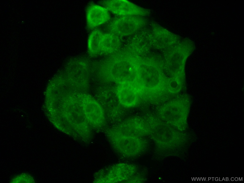 PSAT1 Polyclonal antibody