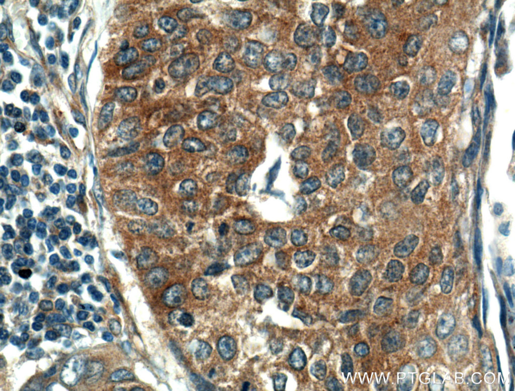 KEAP1 Polyclonal antibody