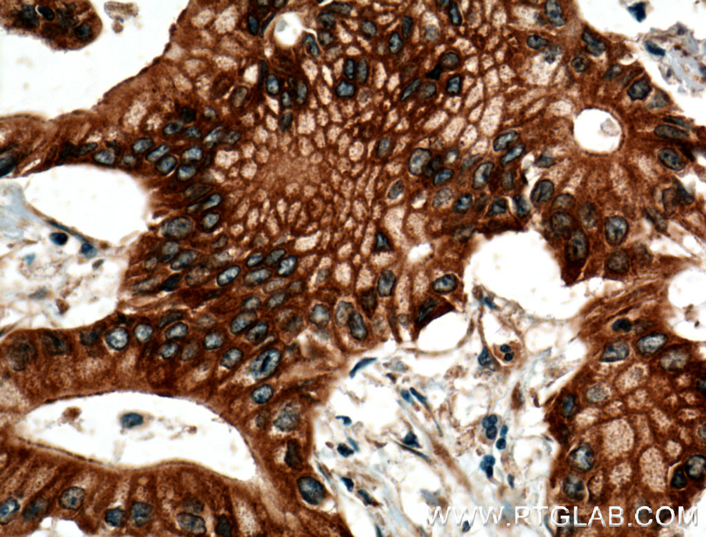 BLK Polyclonal antibody