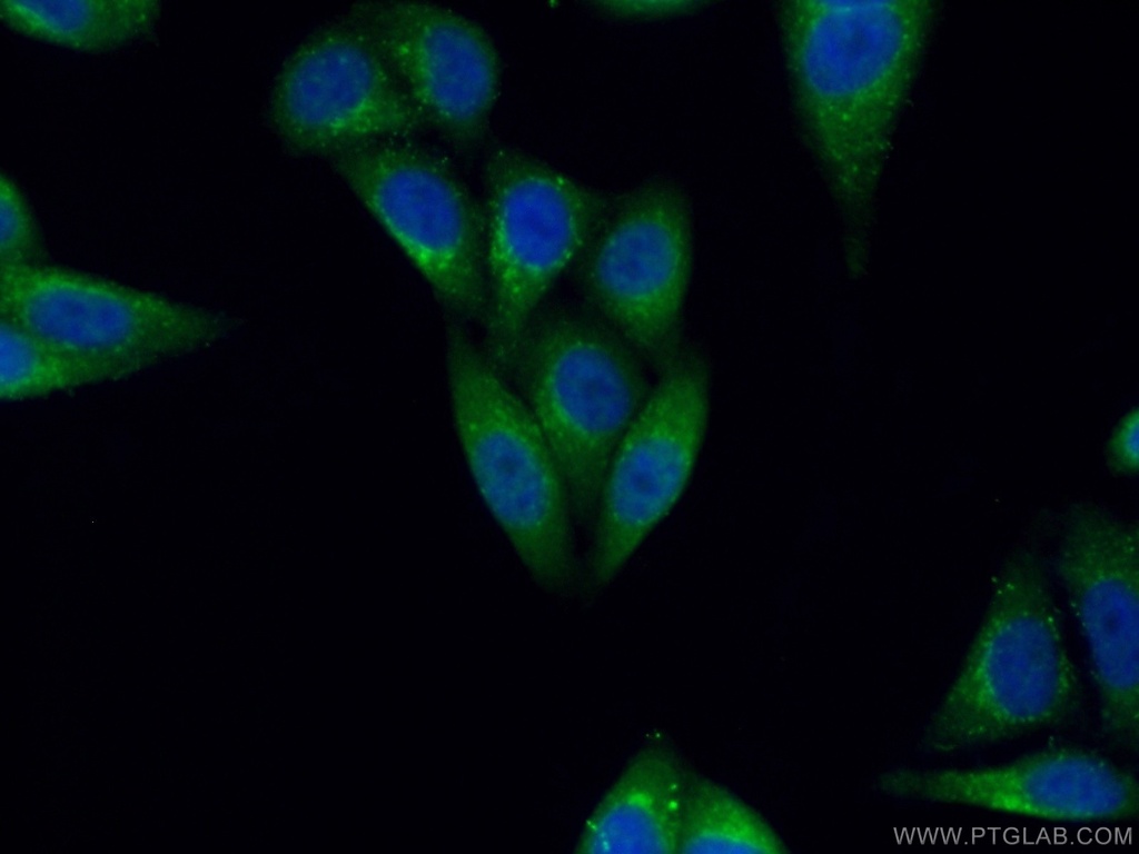 DAD1 Polyclonal antibody
