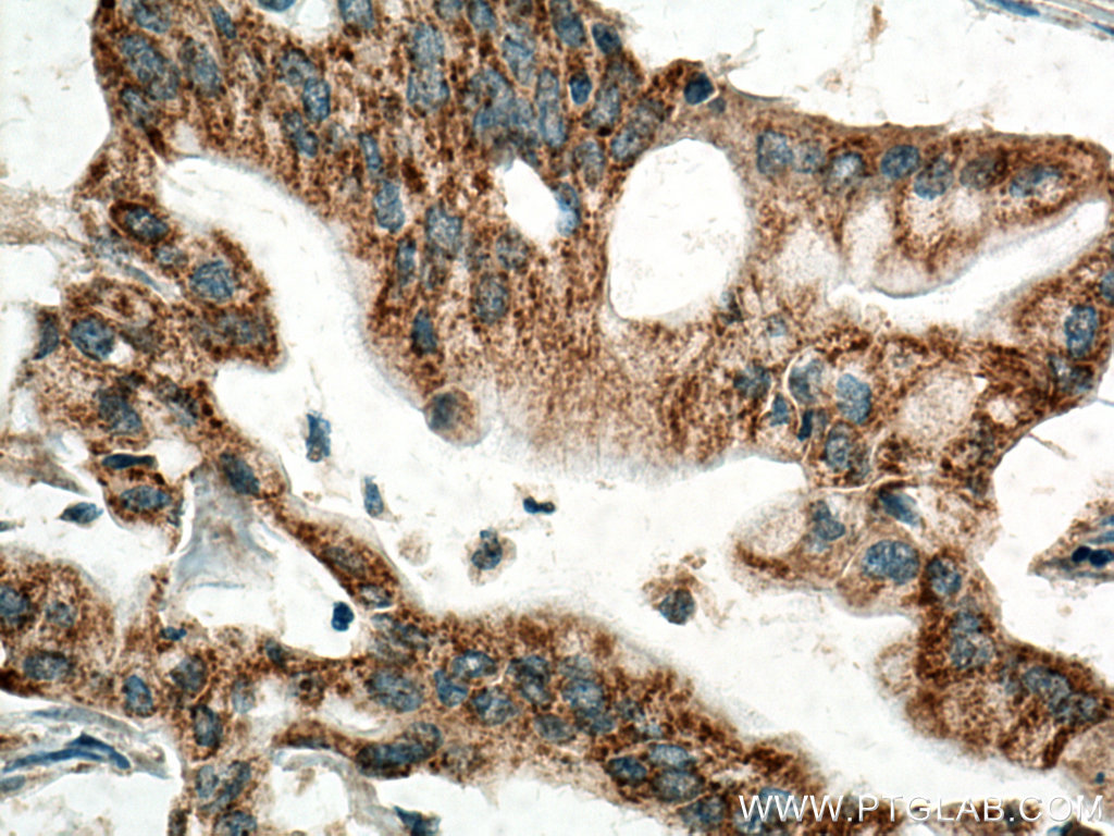MAOA Polyclonal antibody