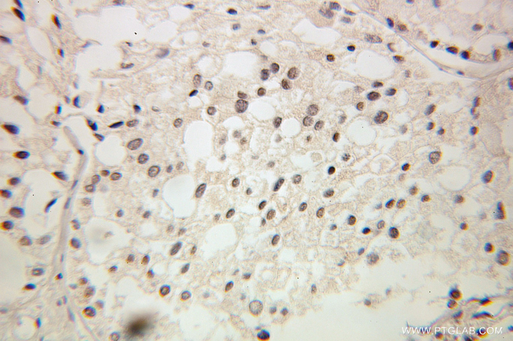 GTF2A2 Polyclonal antibody
