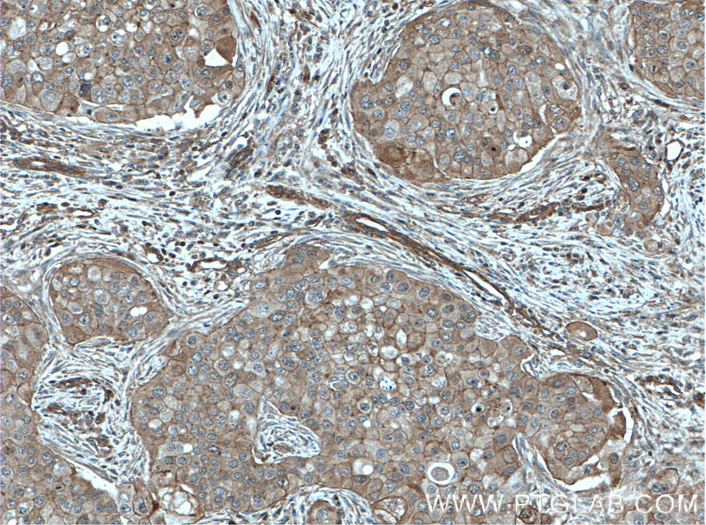 Calmodulin Polyclonal antibody