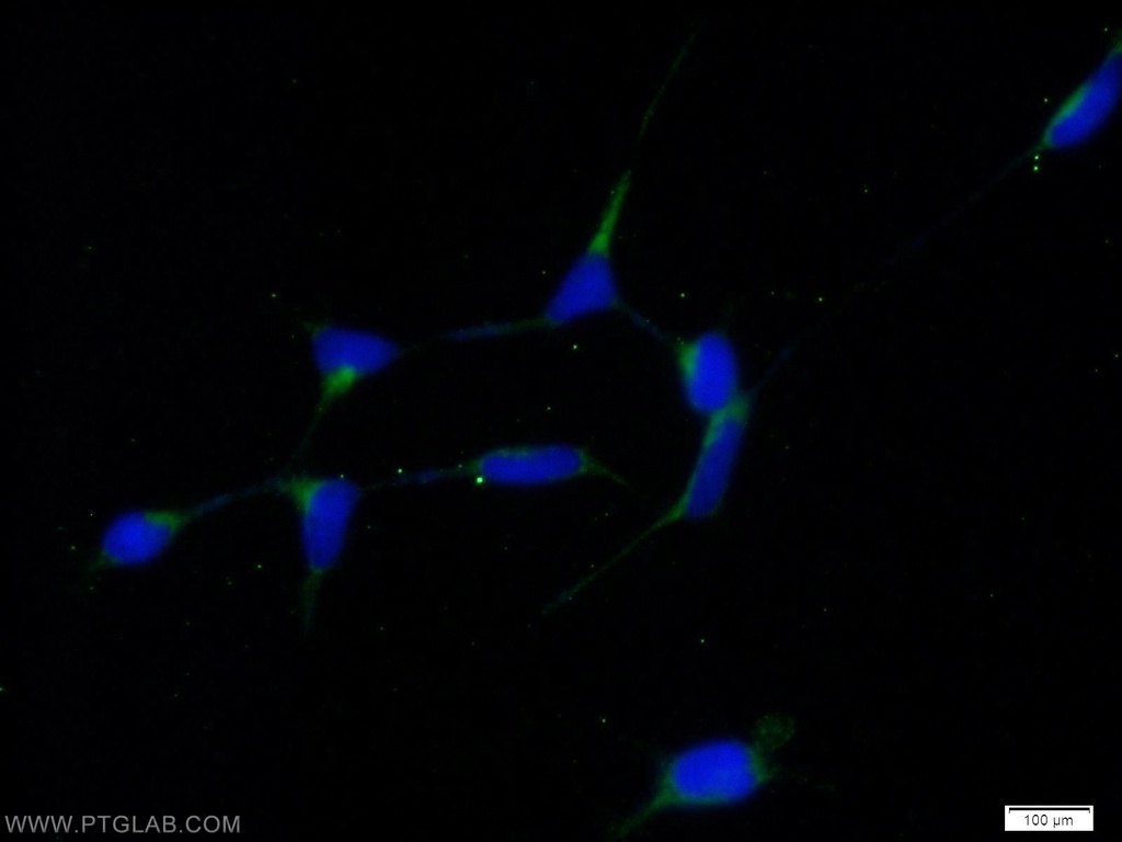 RABAC1 Polyclonal antibody