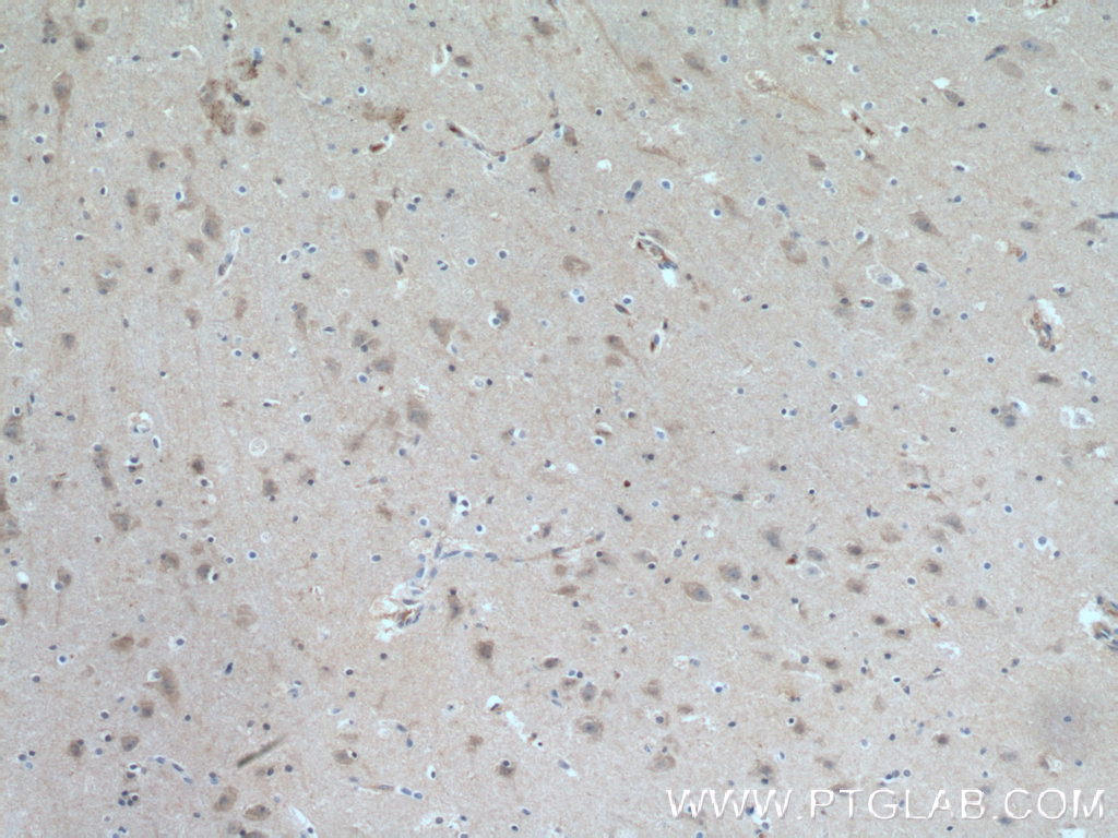 ITPK1 Polyclonal antibody