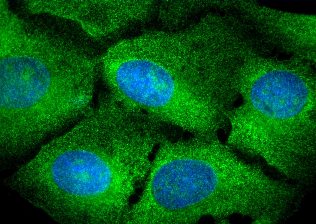 PELO Polyclonal antibody