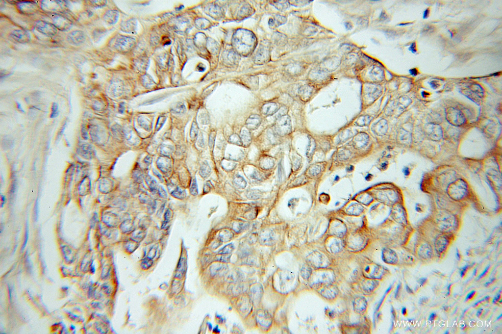 IA-2/PTPRN Polyclonal antibody