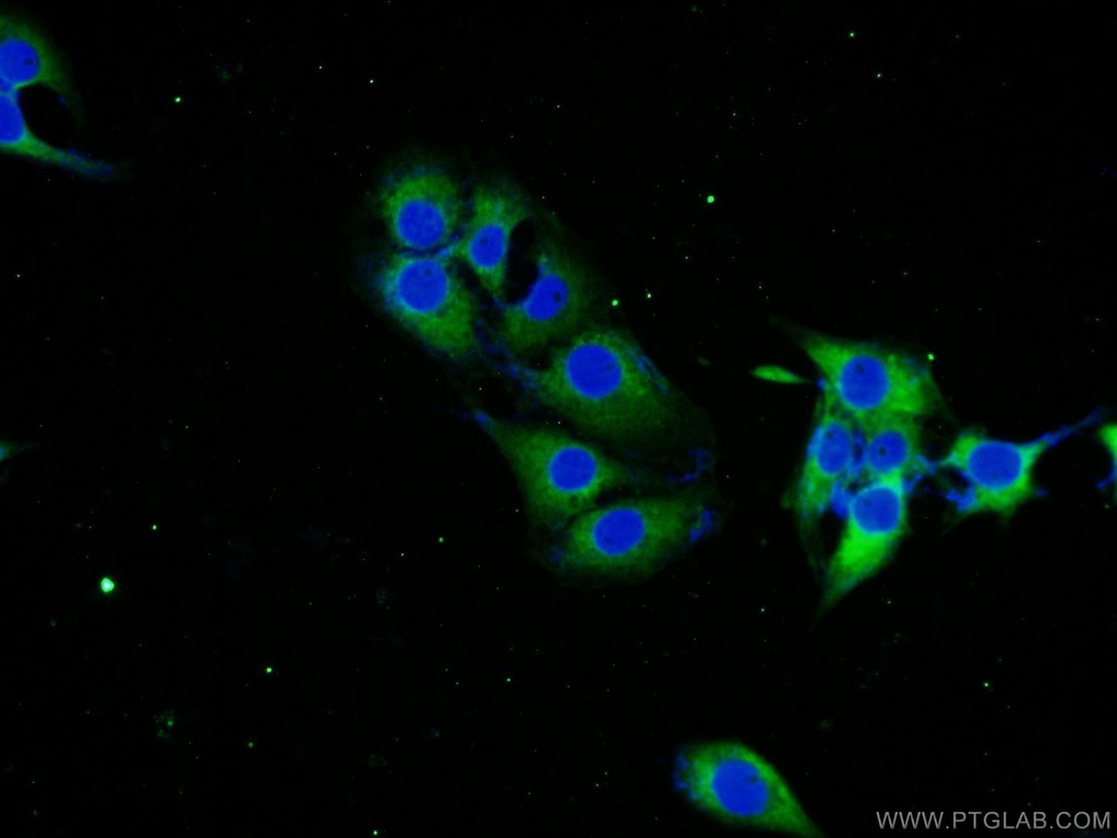 STMN2 Polyclonal antibody