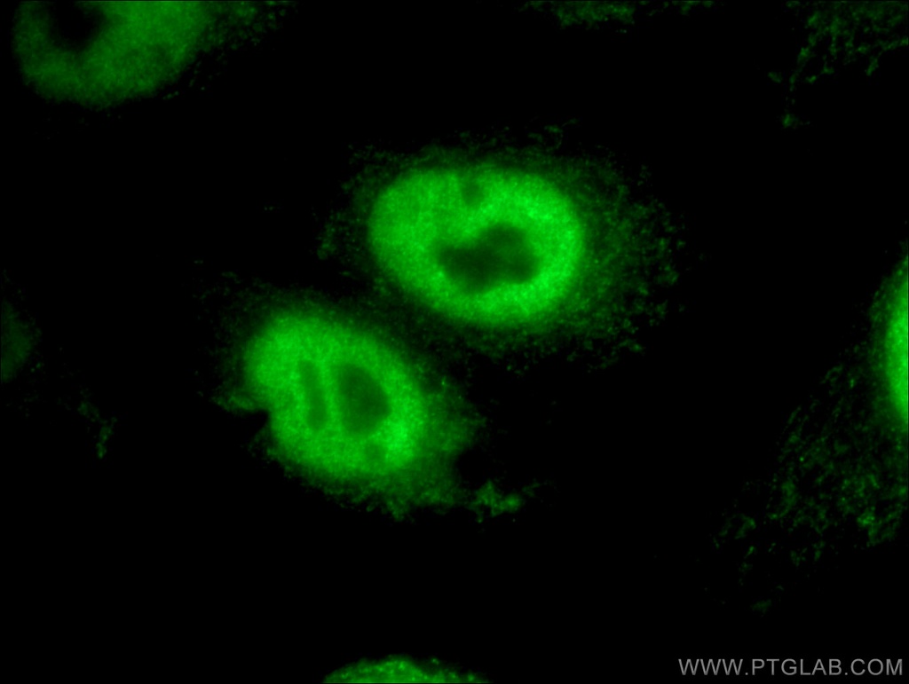 RBM15 Polyclonal antibody