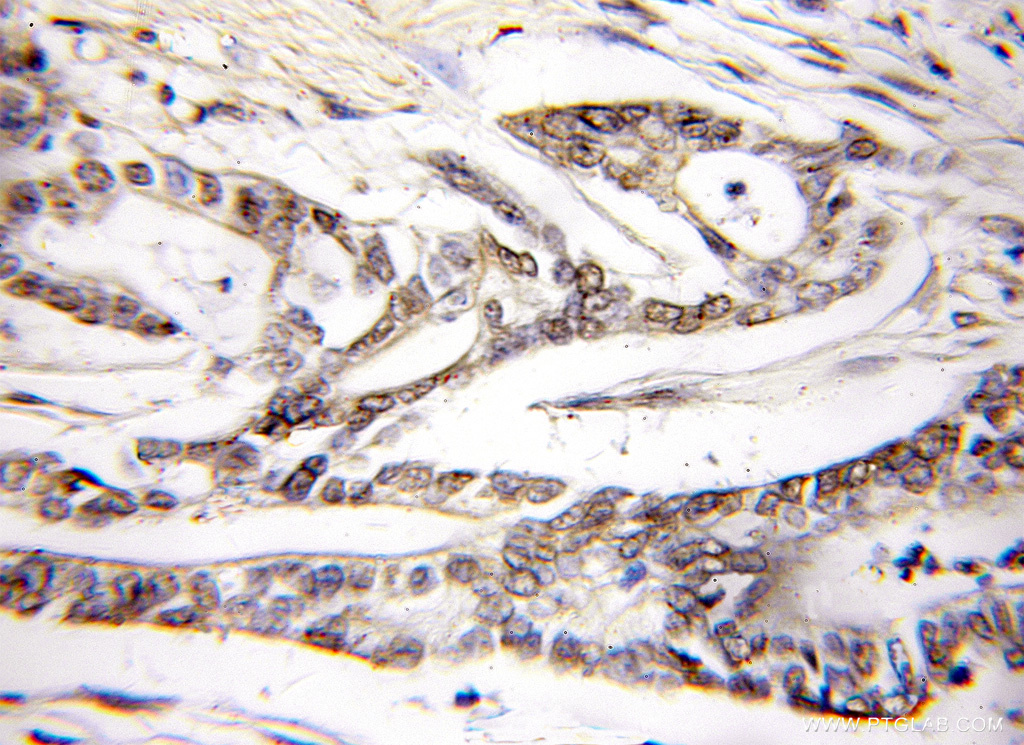 PLCD4 Polyclonal antibody