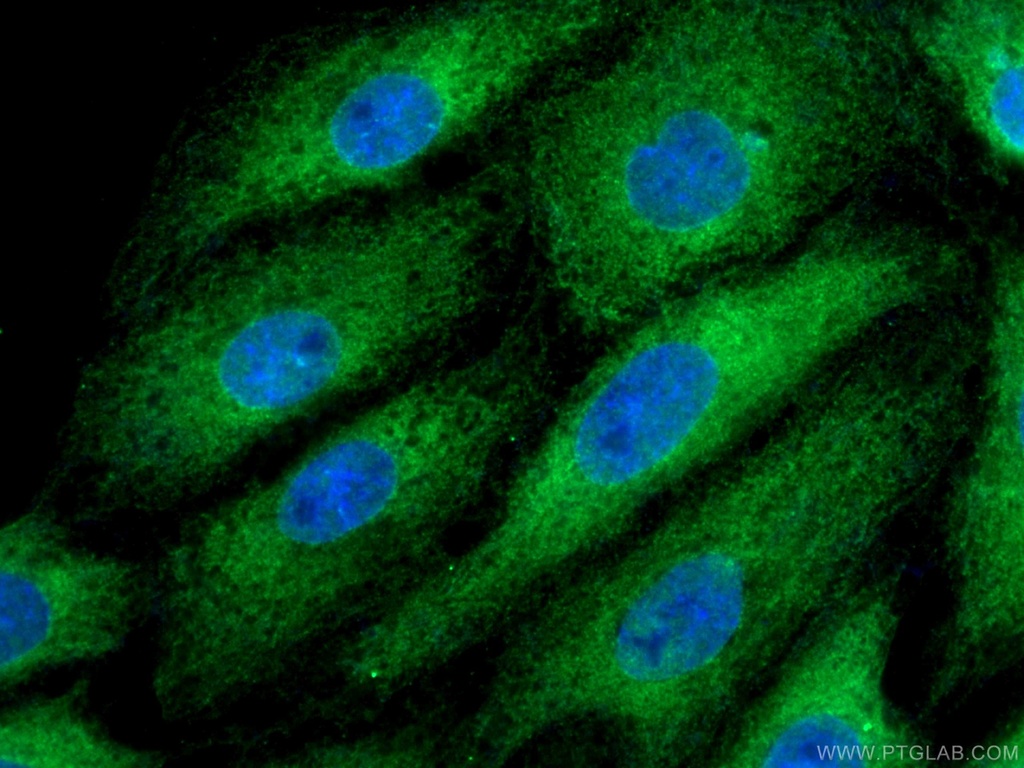 BAG3 Polyclonal antibody