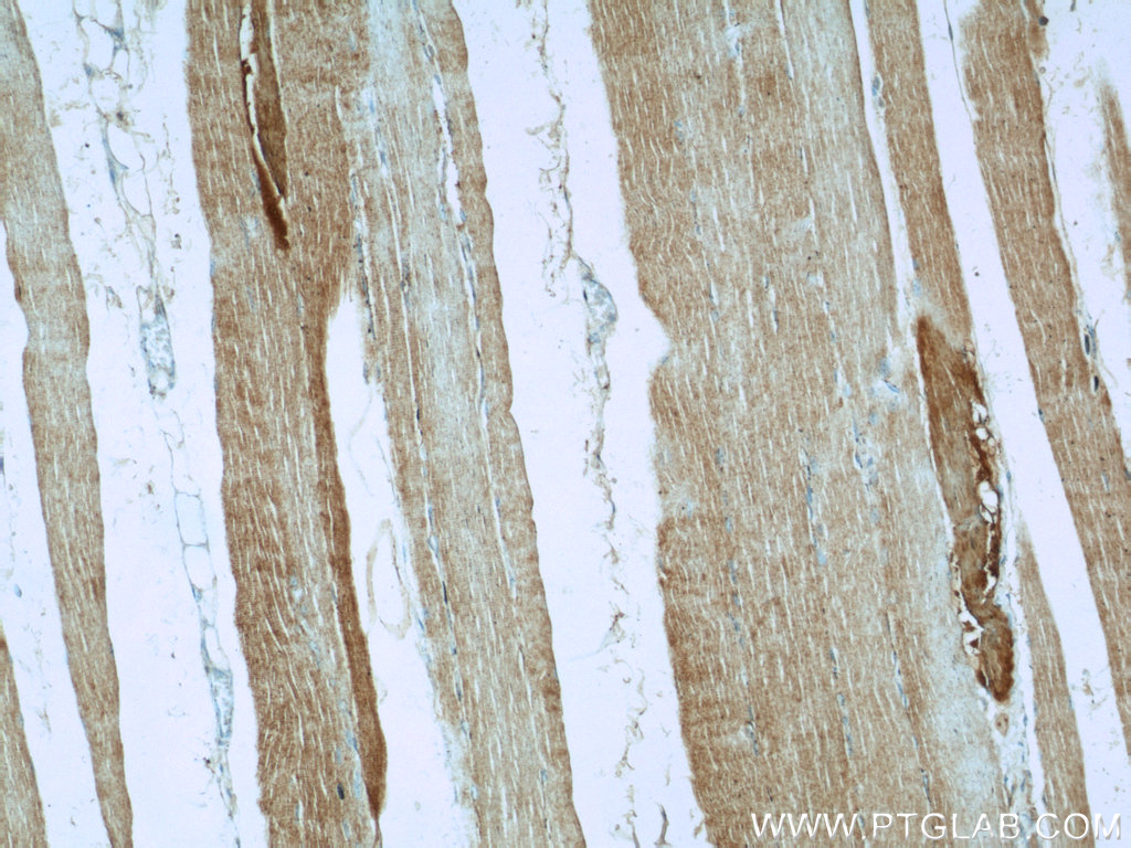 AGPAT1 Polyclonal antibody