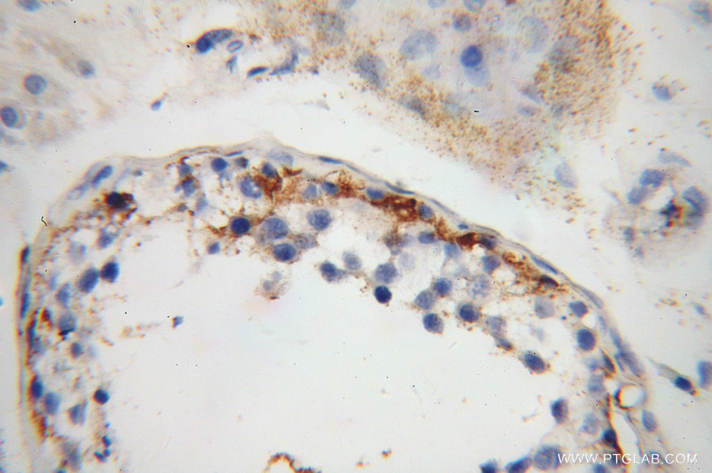 IFT81 Polyclonal antibody