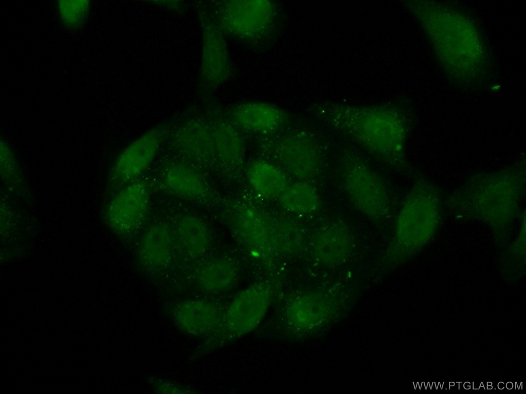 CSNK2A2 Polyclonal antibody