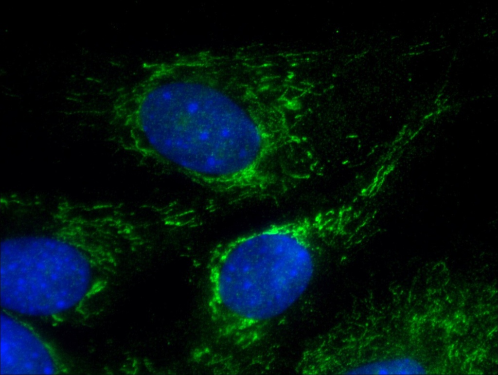 CHRNA1 Polyclonal antibody