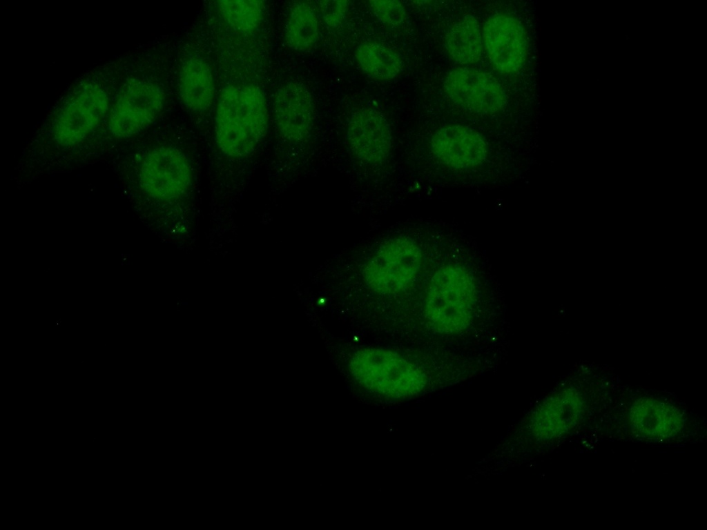 PKNOX1 Polyclonal antibody
