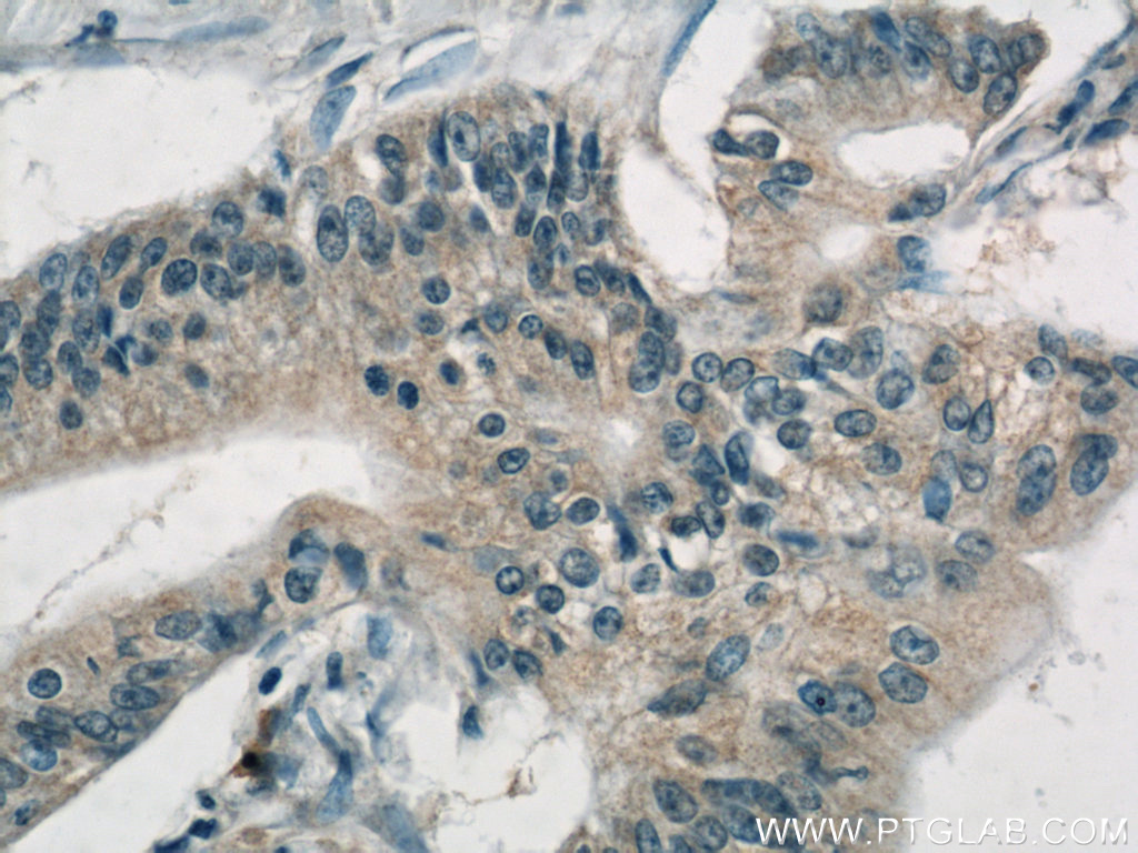AP1M2 Polyclonal antibody