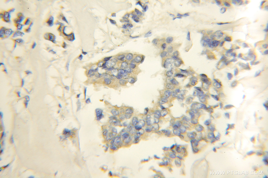 RNF34 Polyclonal antibody