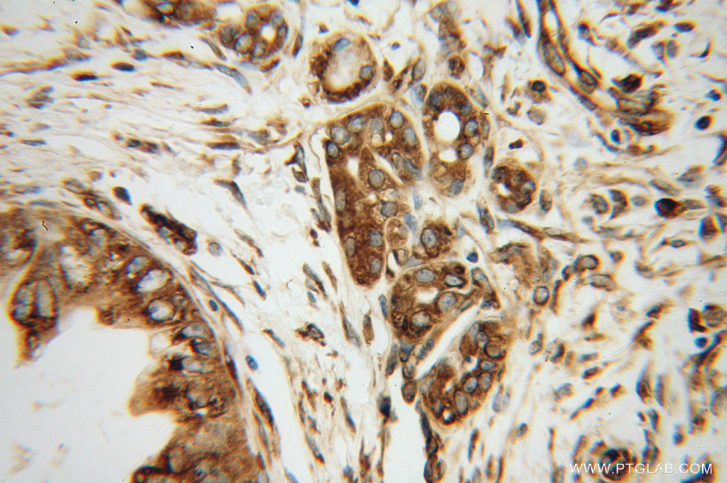 EEF1D Polyclonal antibody