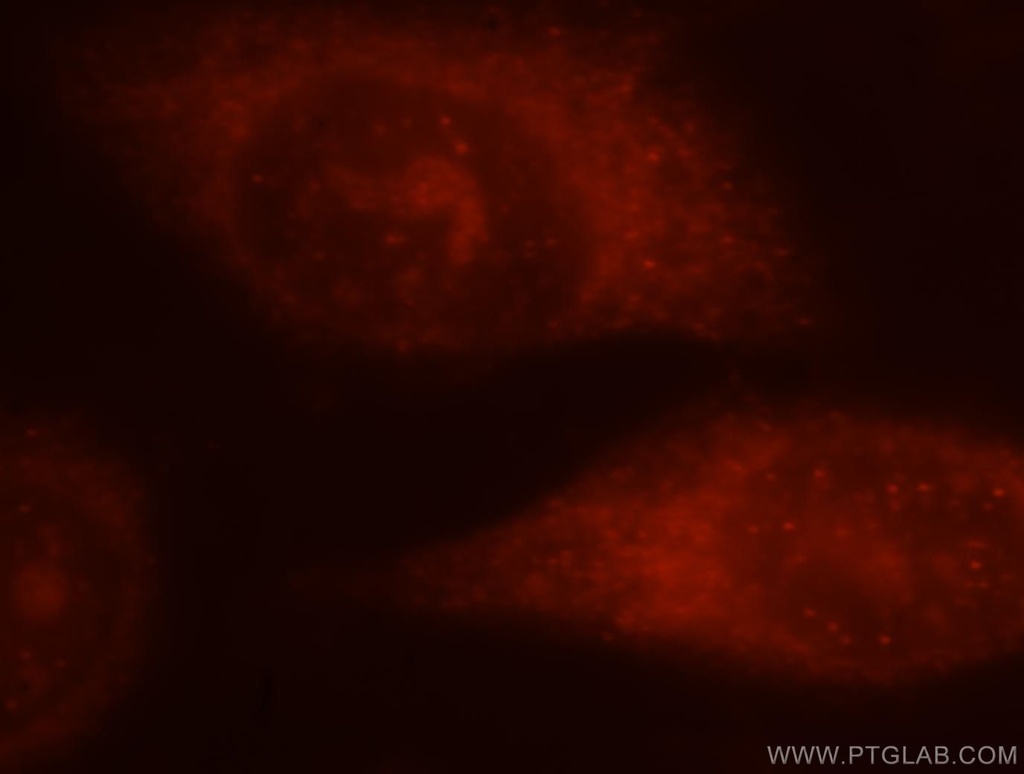 5 Lipoxygenase Polyclonal antibody