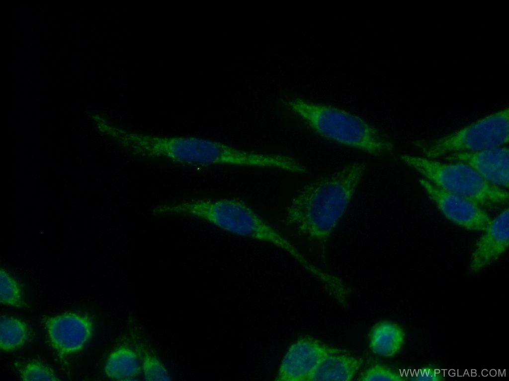JNK Polyclonal antibody