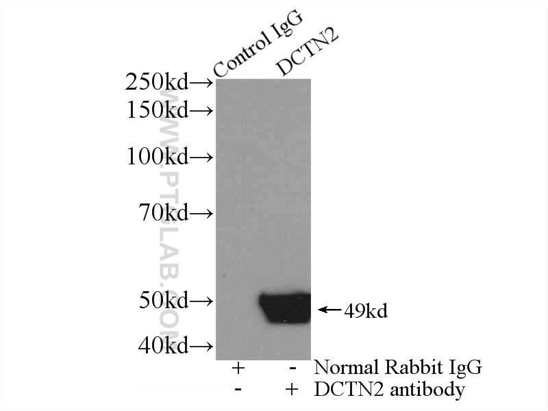 Dynamitin (1-83 AA) Polyclonal antibody
