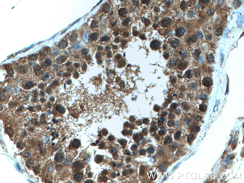 FKBPL Polyclonal antibody