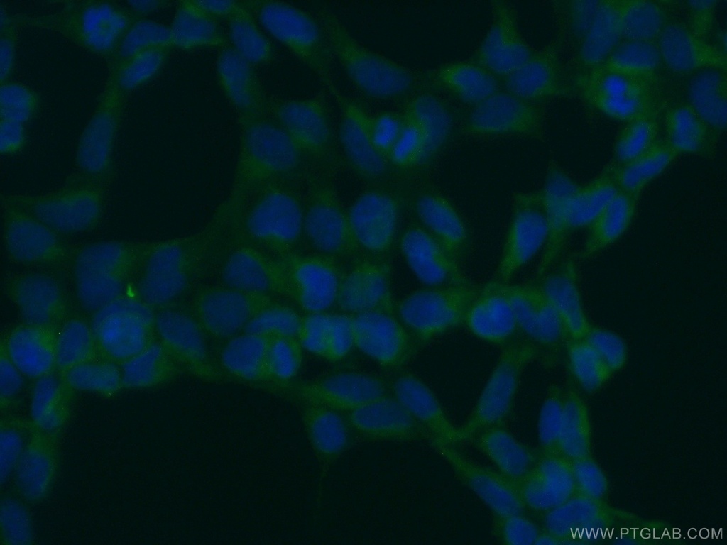 OS9 Polyclonal antibody