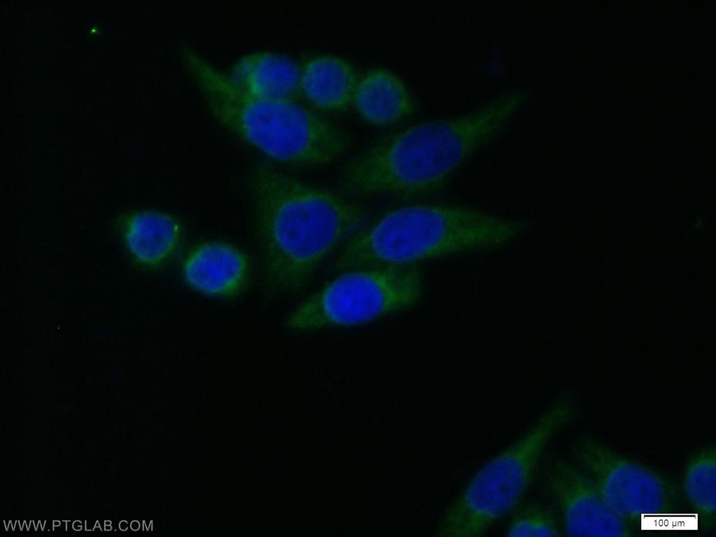 RB1CC1 Polyclonal antibody