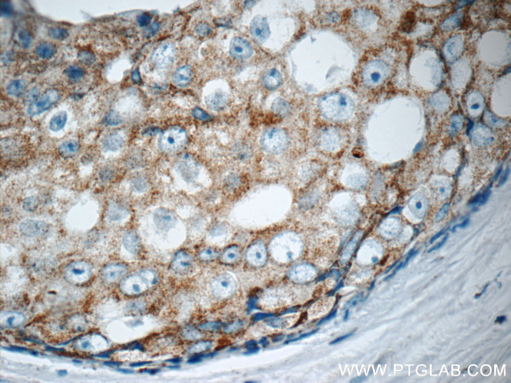 MATK Polyclonal antibody