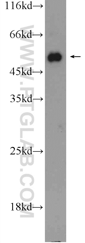 ACVR1B Polyclonal antibody