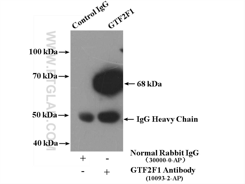 GTF2F1 Polyclonal antibody