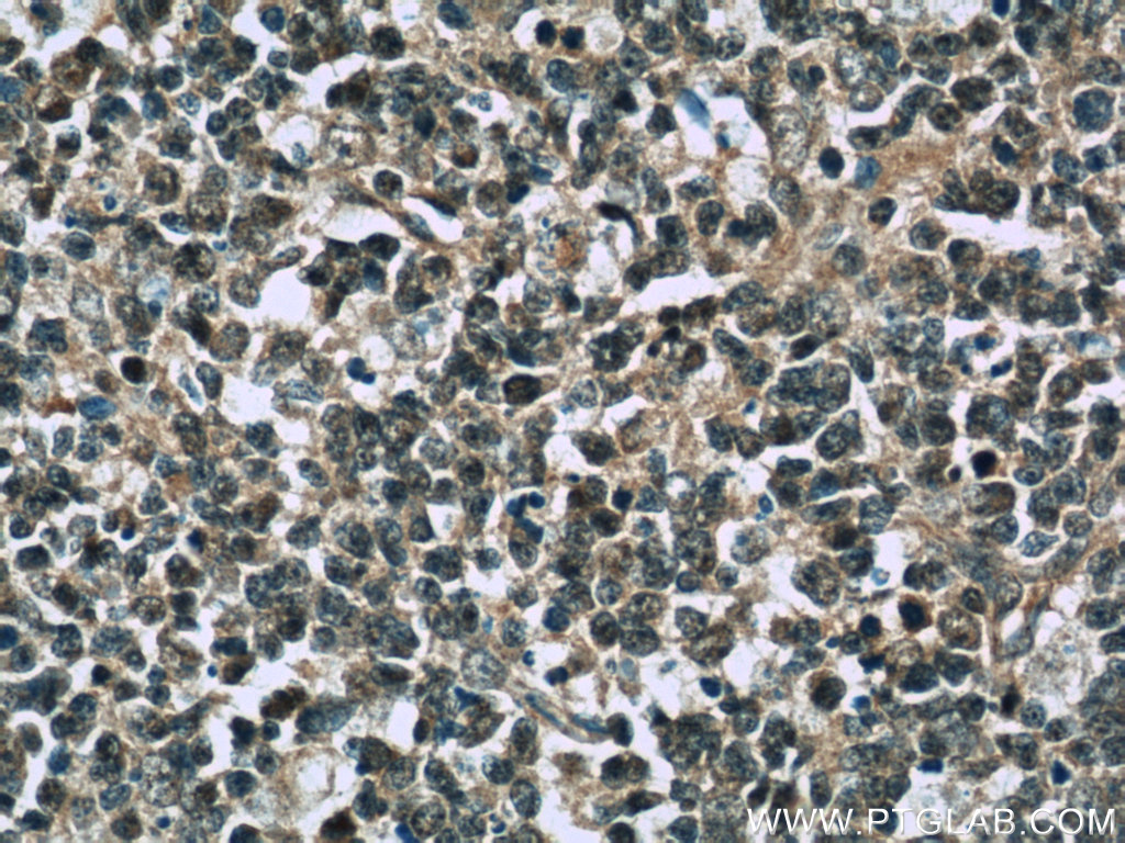 TFPT Polyclonal antibody