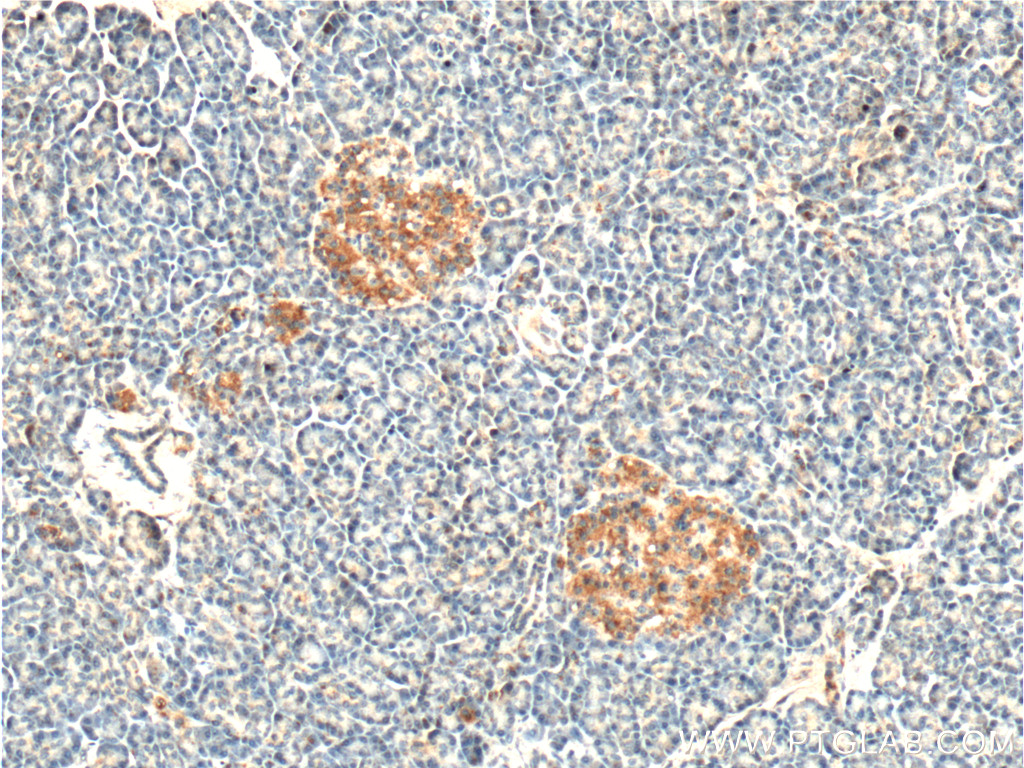 PCTAIRE1 Polyclonal antibody