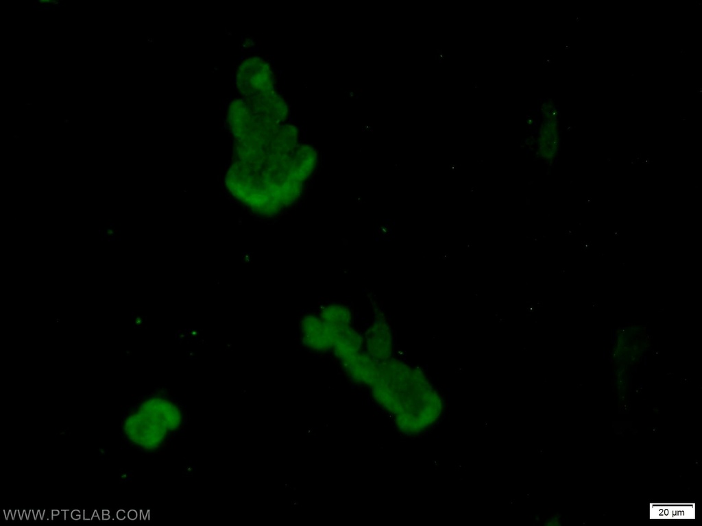 AKAP8L Polyclonal antibody