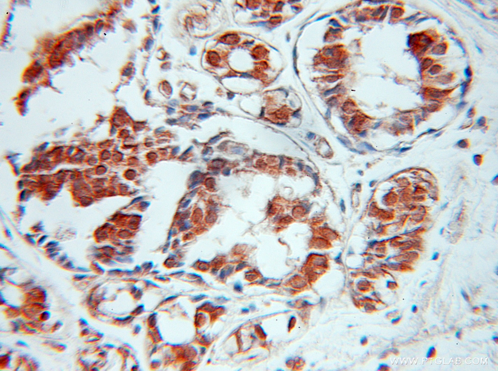 SPIN2B Polyclonal antibody