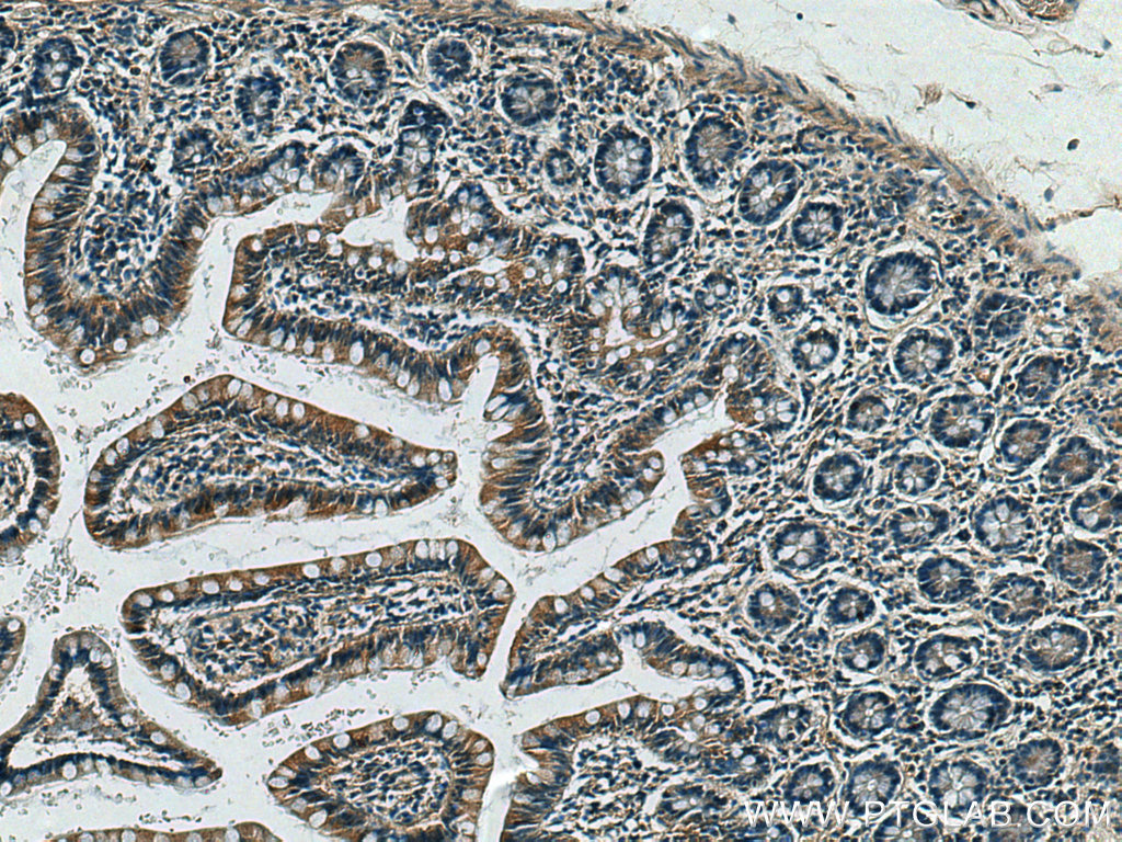 CX3CL1 Polyclonal antibody