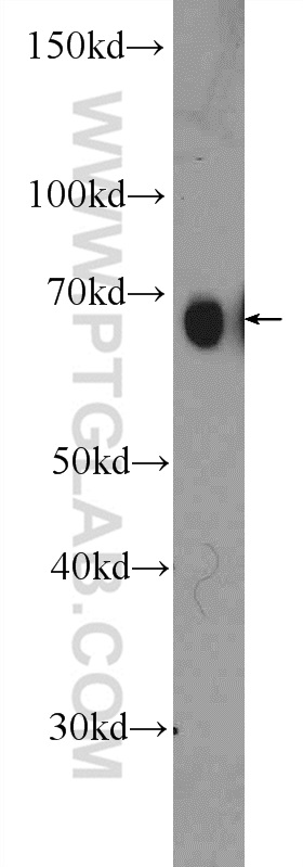 PRC1 Polyclonal antibody