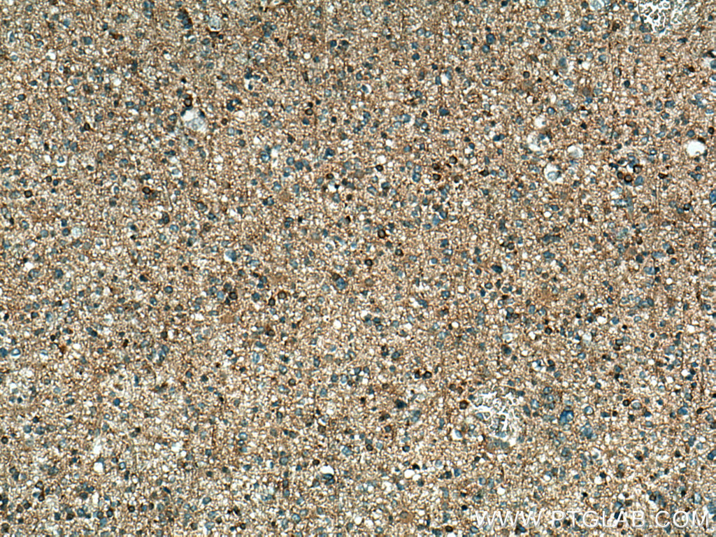 GDI2 Polyclonal antibody