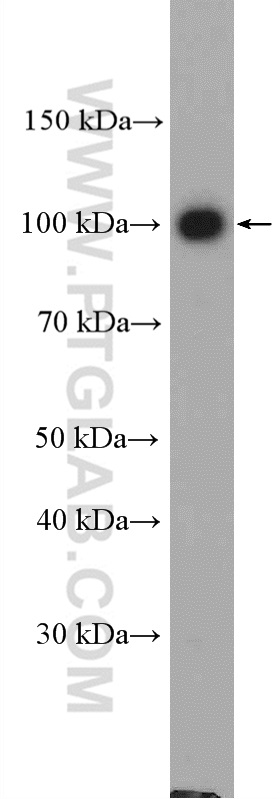Adaptin Polyclonal antibody