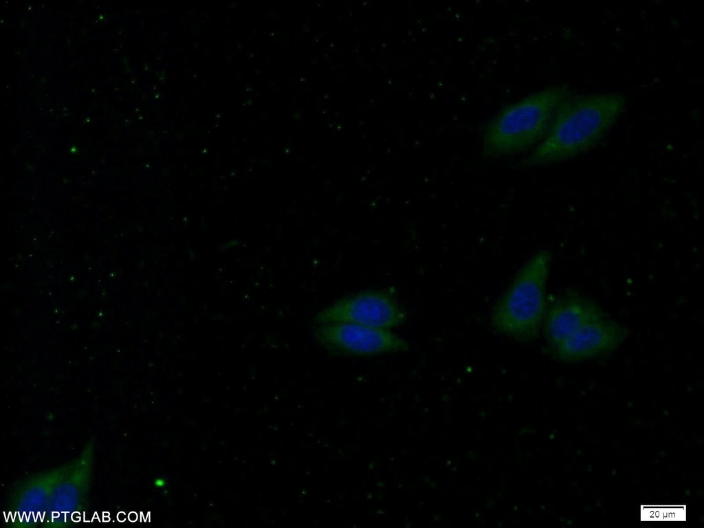 MNK1 Polyclonal antibody