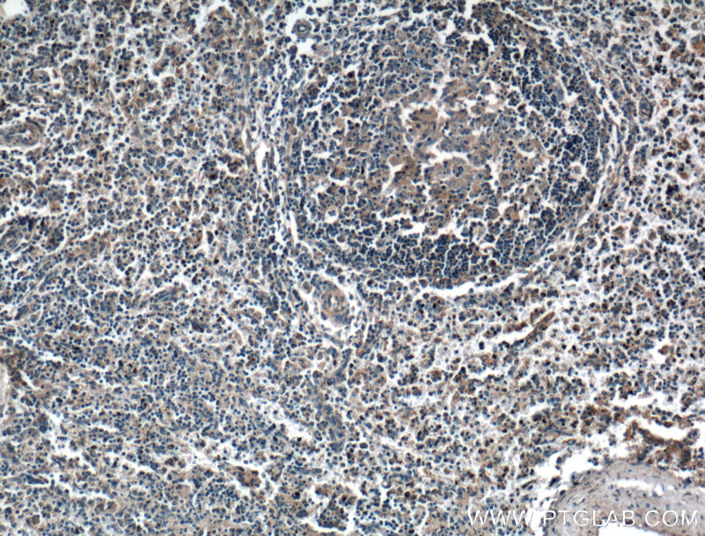 HVEM/TNFRSF14 Polyclonal antibody