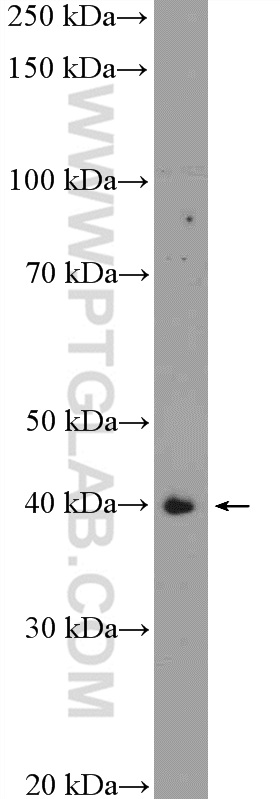 TMOD1 Polyclonal antibody