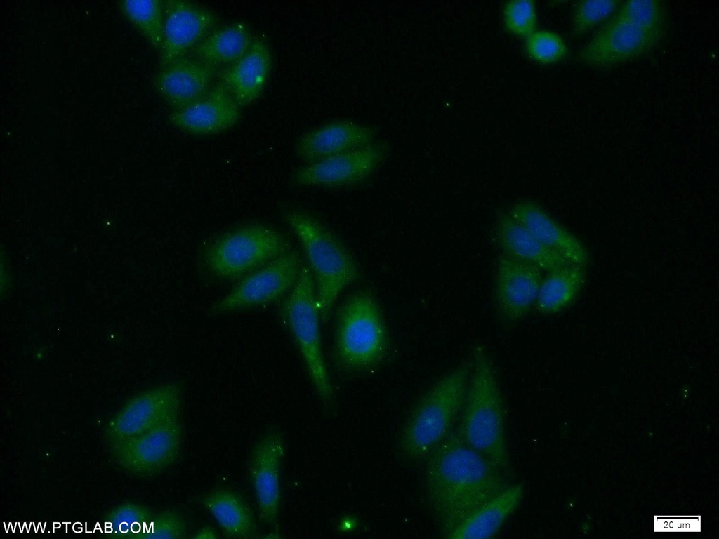 PREB Polyclonal antibody