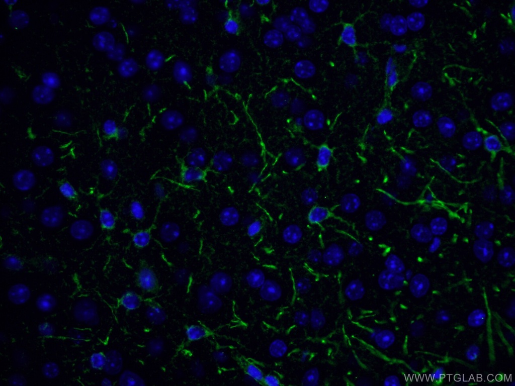 tPA Polyclonal antibody