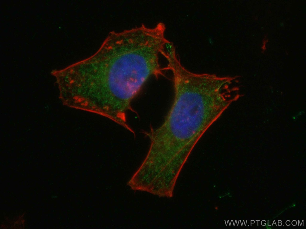 GNAS Polyclonal antibody