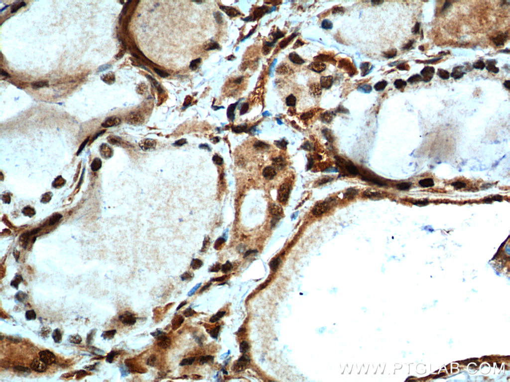 MYCN Polyclonal antibody