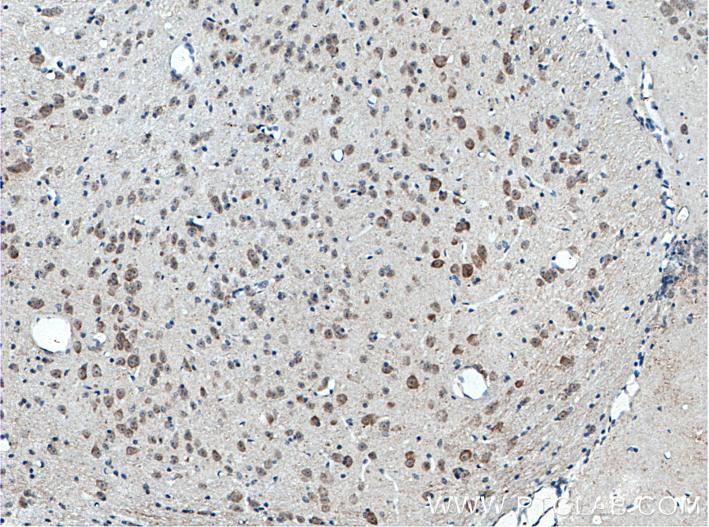 C17orf81 Polyclonal antibody