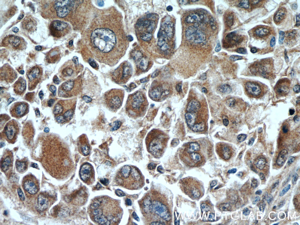 DOPA decarboxylase Polyclonal antibody