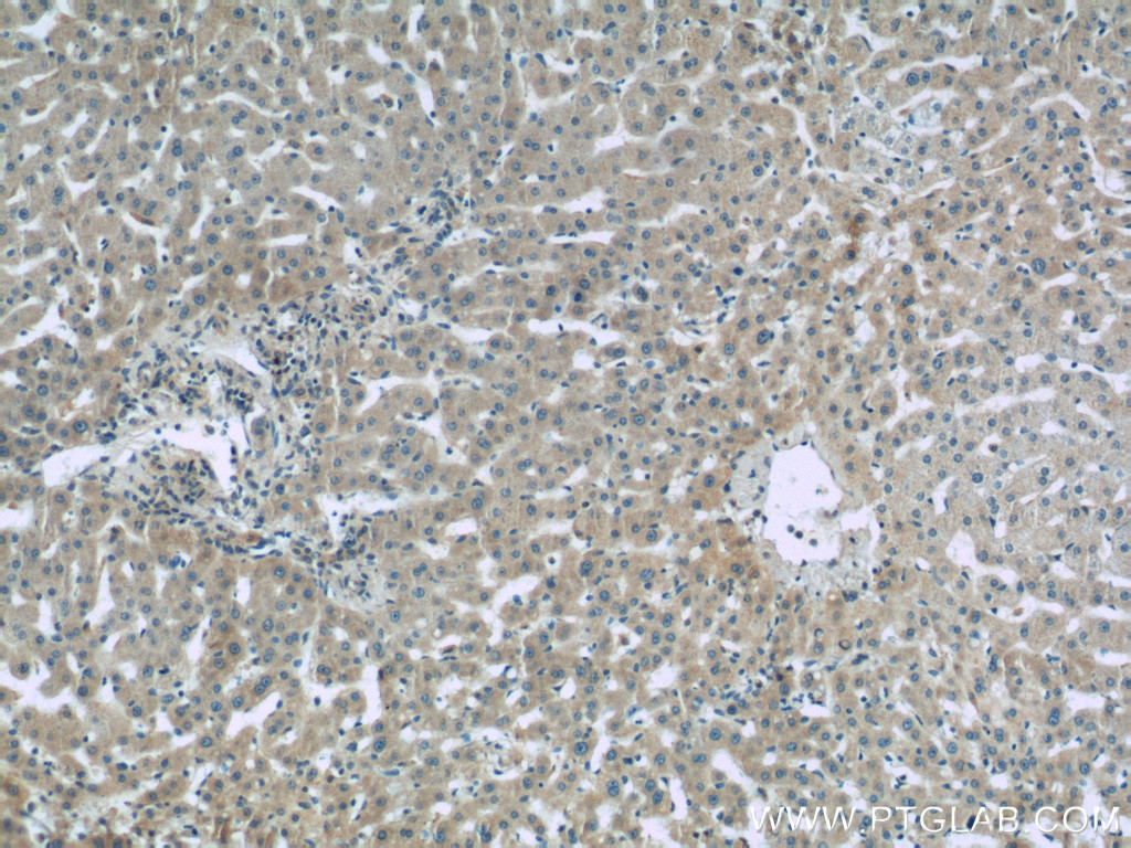 Complement factor B Polyclonal antibody